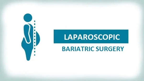 Laparoscopic Bariatric Surgery: A Minimally Invasive Technique To Get Rid Of Overweight
