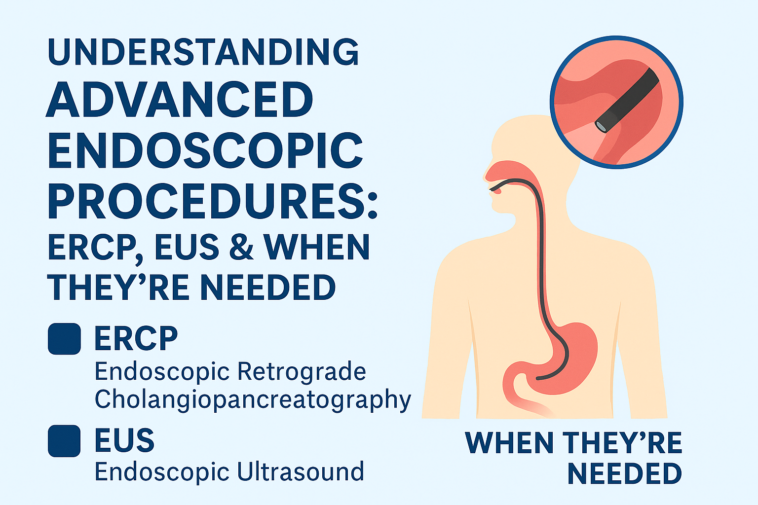 Understanding Advanced Endoscopic Procedures: ERCP, EUS & When They’re Needed