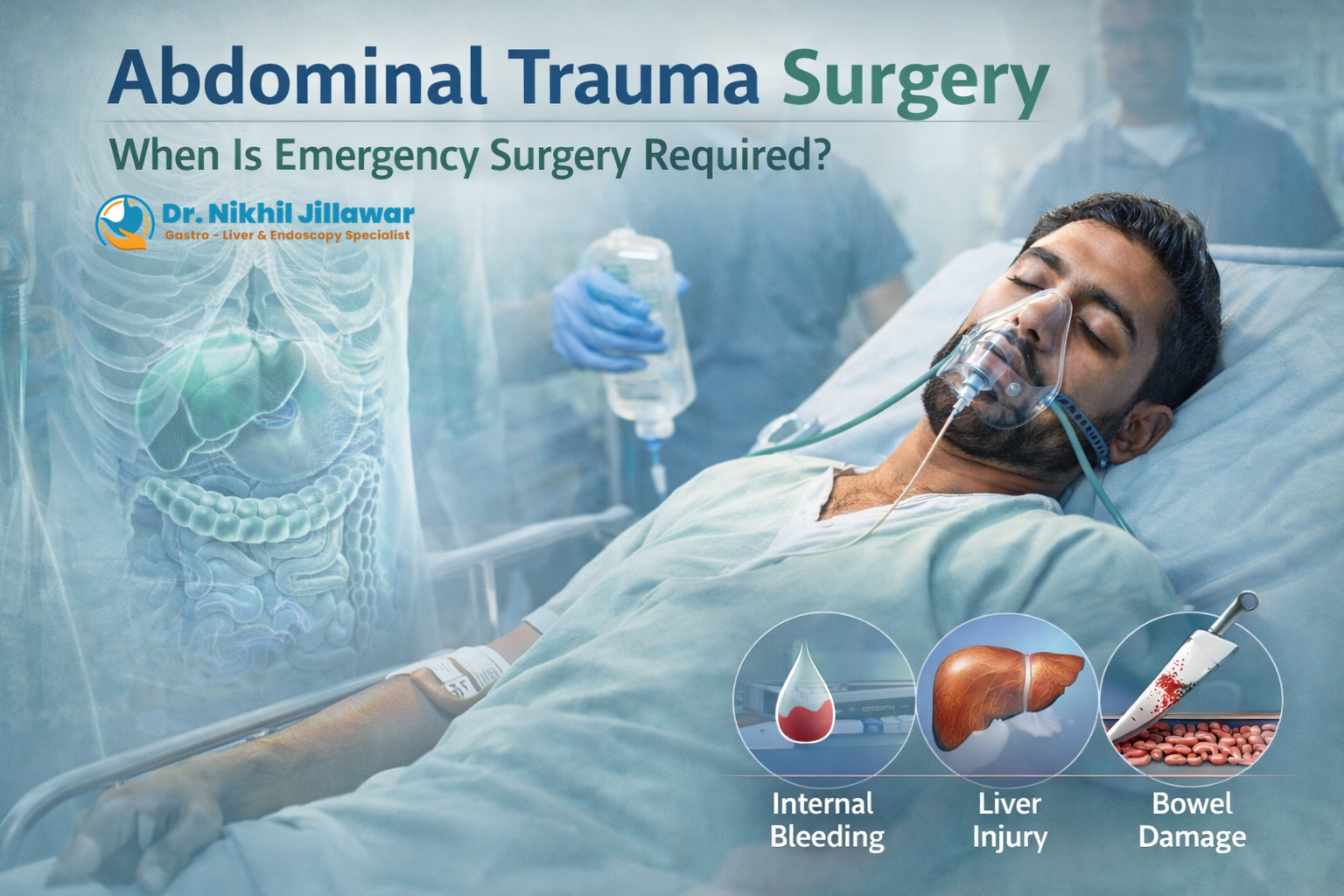 Abdominal Trauma: When Is Emergency Surgery Required?